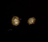Agrimonia eupatoria. Плод (поперечный разрез). Курская обл., г. Железногорск, пойма р. Погарщина. 13 декабря 2009 г.